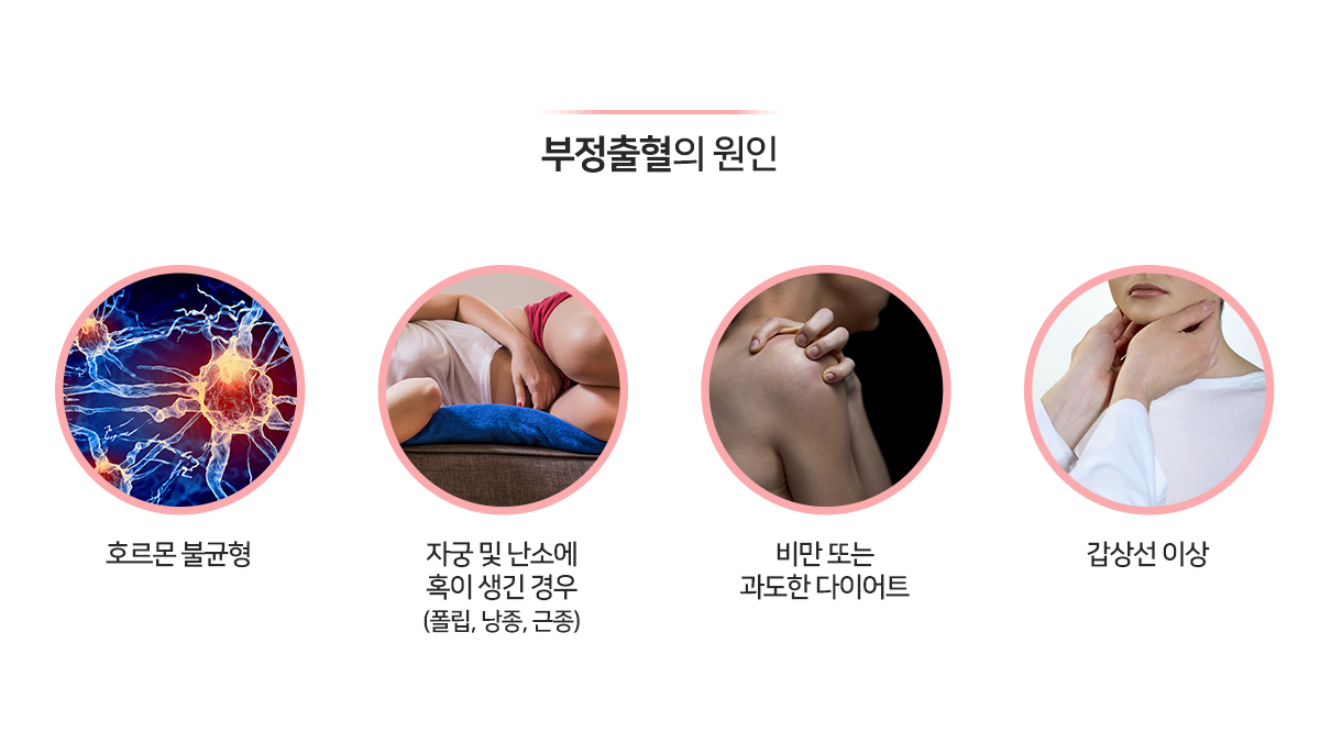이미지명