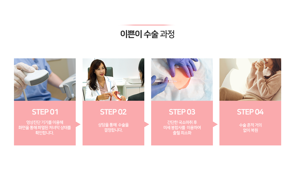 이미지명